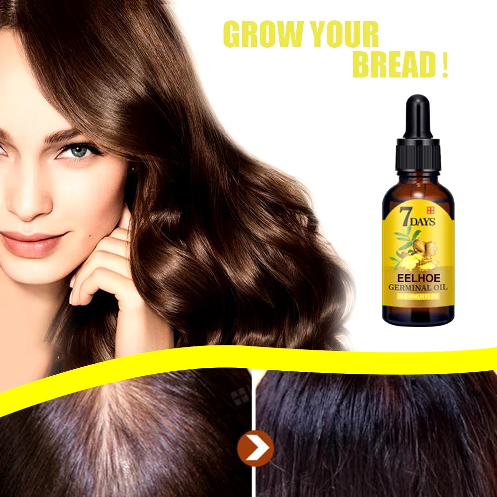 Revitalize Your Hair with EELHOE Ginger Hair Growth Oil - Natural Anti - Hair Loss Treatment for Hydration & Nourishment - SIRISE LLC